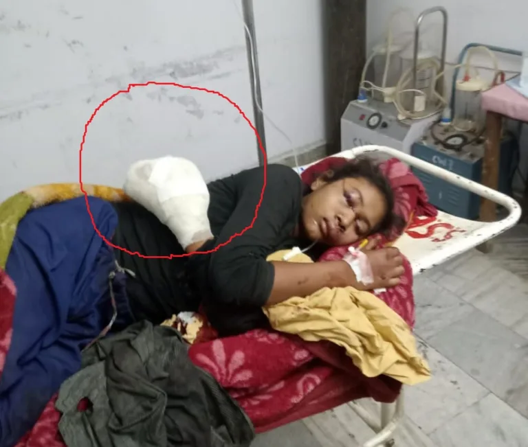 Girl was watching reels on mobile, suddenly her hand got torn and flew away