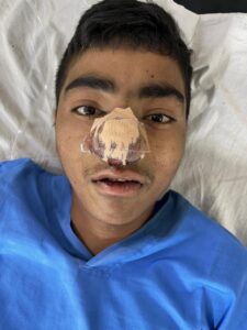 Successful operation of brain extension tumor without incision, patient is healthy